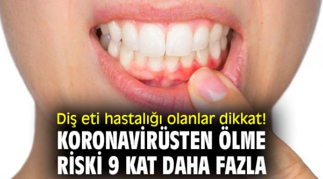 Diş eti hastalığı olanlar dikkat! Koronavirüsten ölme riski 9 kat daha